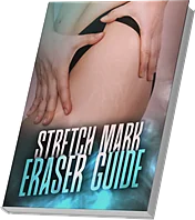 Stretch Mark Eraser Guide